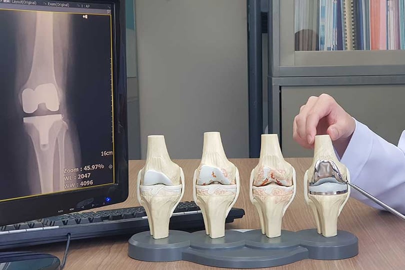 Does Health Insurance Cover Chiropractic Care?